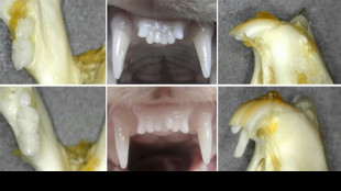 Des chercheurs japonais travaillent sur un médicament faisant repousser les dents