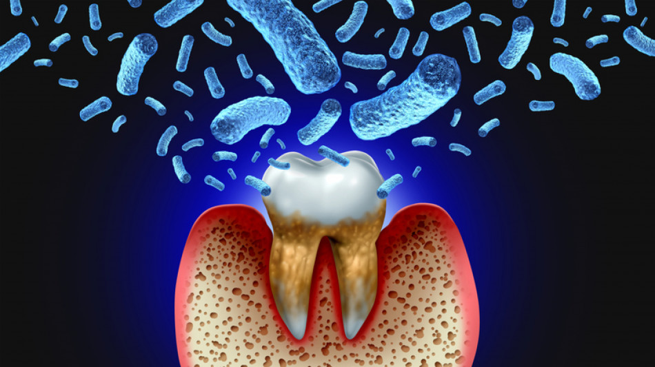 Sviluppata una terapia mirata per la parodontite basata sulla luce